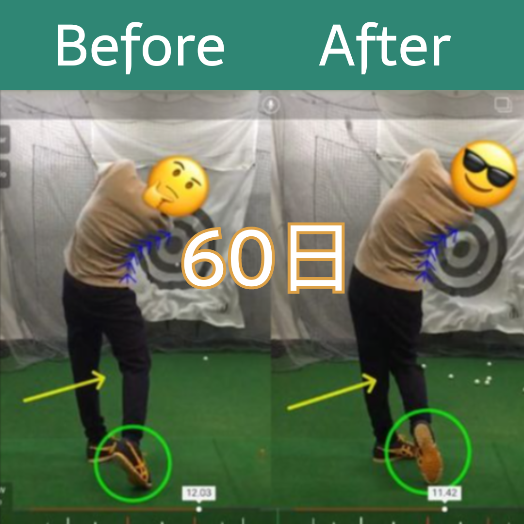 Before After 1