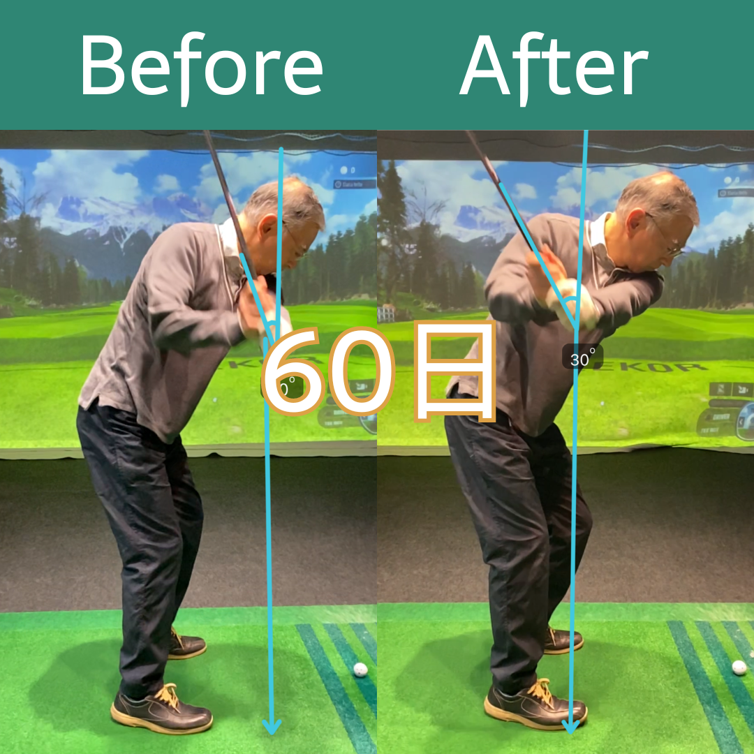 Before After 13