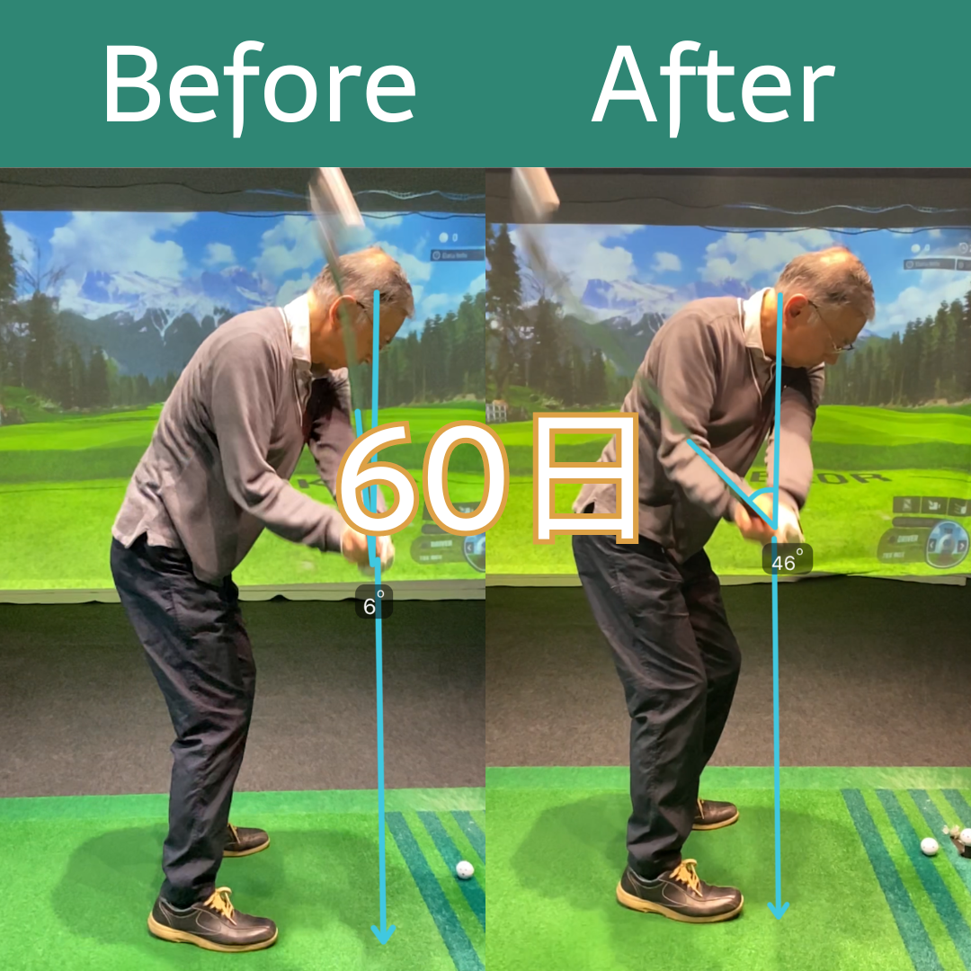 Before After 14