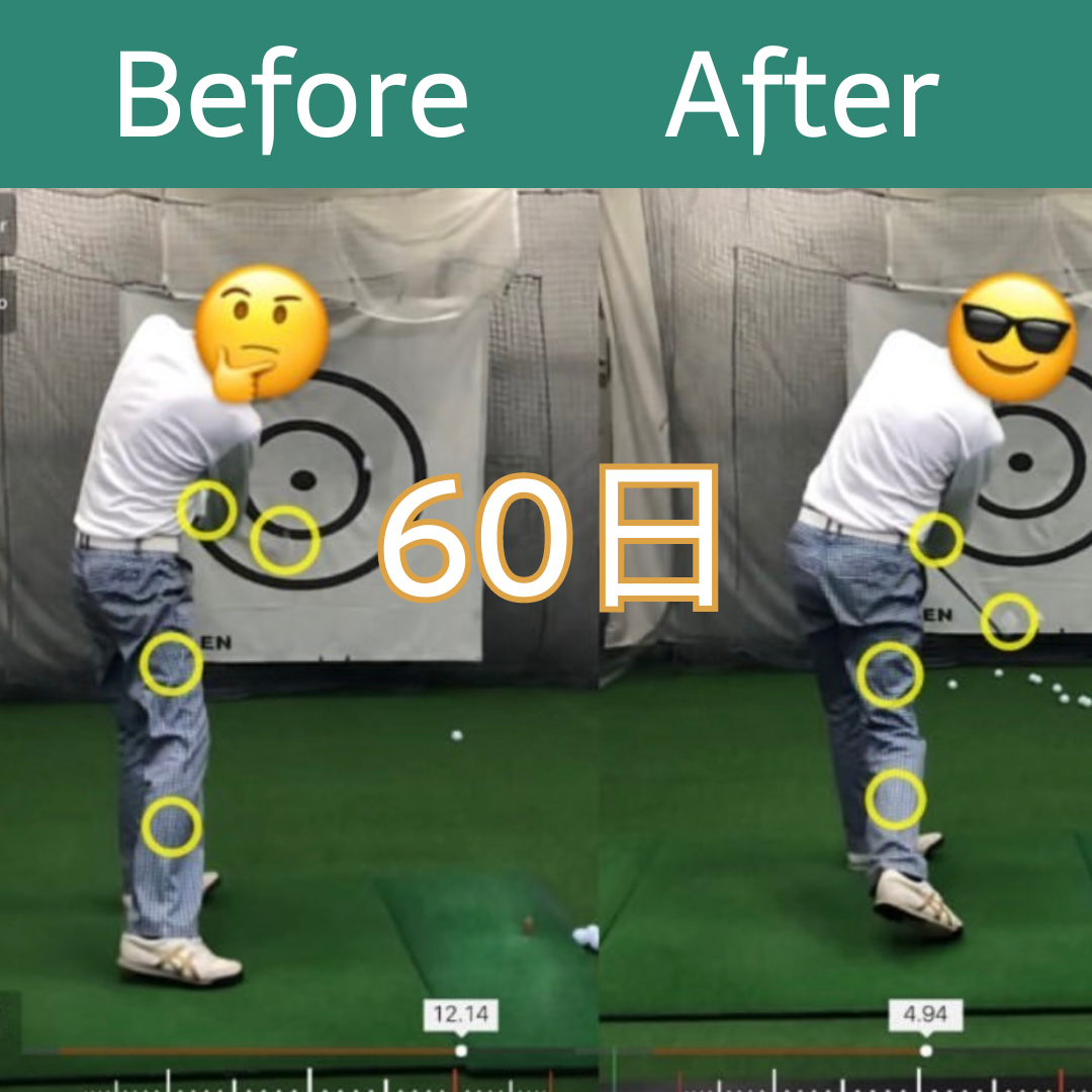 Before After 3