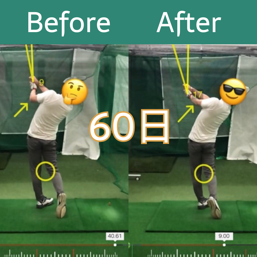 Before After 2