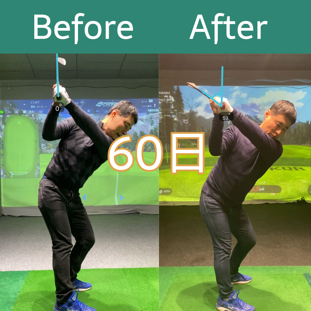 Before After 19