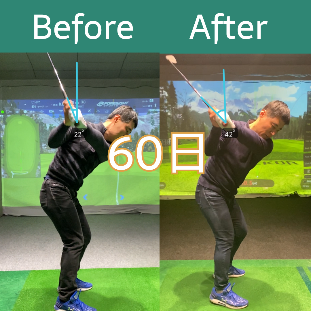 Before After 20