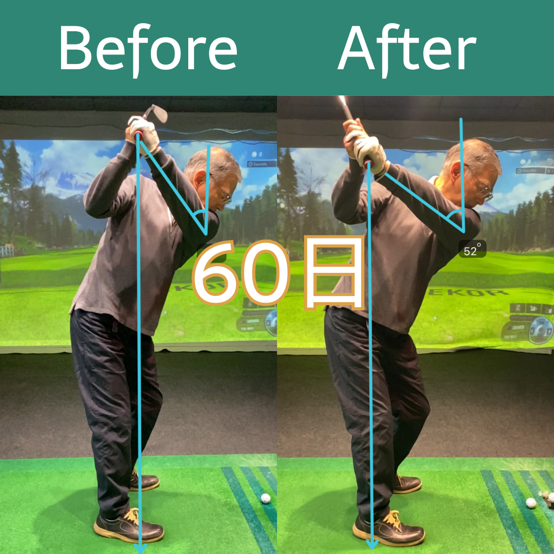 Before After 12